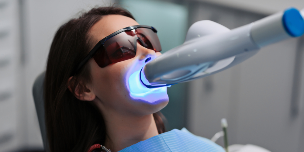 Revolutionising Smiles with Modern Teeth Whitening Techniques