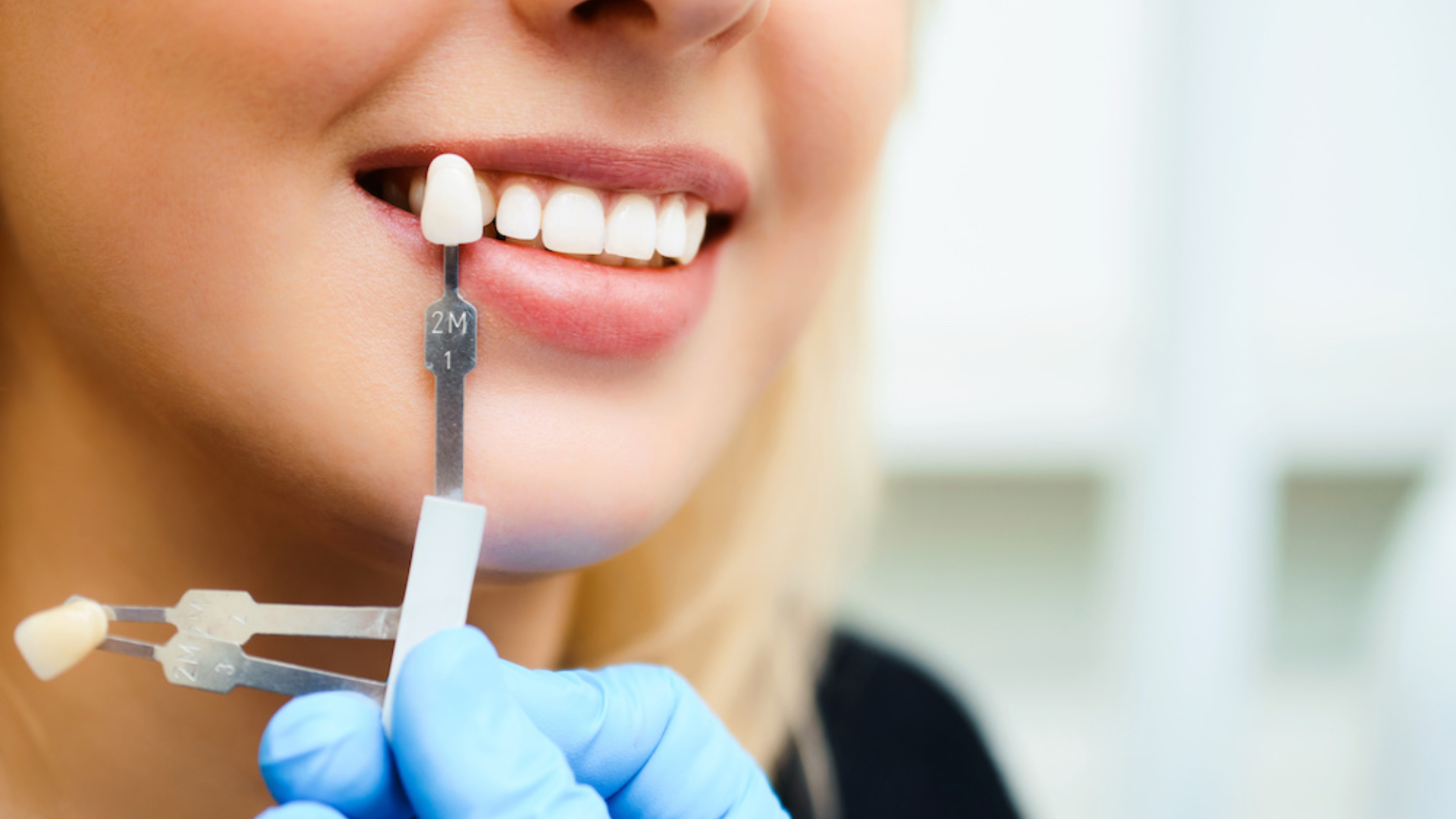 How to Get Dental Implants and the Importance of Dentures